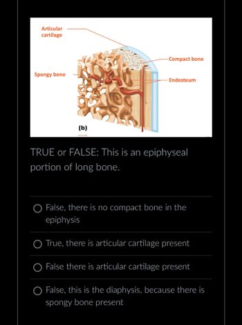 Articular
cartilage
Spongy bone
(b)
Compact bone
Endosteum
TRUE or FALSE: This is an epiphyseal
portion of long bone.
O False, there is no compact bone in the
epiphysis
O True, there is articular cartilage present
O False there is articular cartilage present
O False, this is the diaphysis, because there is
spongy bone present