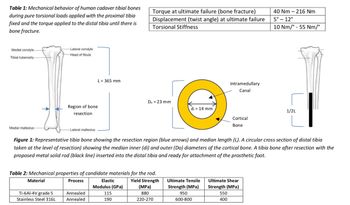 Table 1: Mechanical behavior of human cadaver tibial bones
during pure torsional loads applied with the proximal tibia
fixed and the torque applied to the distal tibia until there is
bone fracture.
Medial condyle
Tibial tuberosity-
Medial malleolus
-Lateral condyle
Head of fibula
Ti-6Al-4V grade 5
Stainless Steel 316L
Region of bone
resection
-Lateral malleolus
L = 365 mm
Annealed
Annealed
Torque at ultimate failure (bone fracture)
Displacement (twist angle) at ultimate failure
Torsional Stiffness
Table 2: Mechanical properties of candidate materials for the rod.
Material
Process
Yield Strength
(MPa)
880
220-270
Do = 23 mm
Elastic
Modulus (GPa)
115
190
d₁ = 14 mm
Figure 1: Representative tibia bone showing the resection region (blue arrows) and median length (L). A circular cross section of distal tibia
taken at the level of resection) showing the median inner (di) and outer (Do) diameters of the cortical bone. A tibia bone after resection with the
proposed metal solid rod (black line) inserted into the distal tibia and ready for attachment of the prosthetic foot.
Intramedullary
Canal
Ultimate Tensile
Strength (MPa)
950
600-800
Cortical
Bone
40 Nm-216 Nm
5° -12°
10 Nm/° - 55 Nm/°
Ultimate Shear
Strength (MPa)
550
400
1/2L