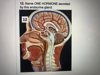 12. Name ONE HORMONE secreted
by this endocrine gland.
12
