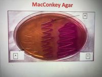 MacConkey Agar
B
A
