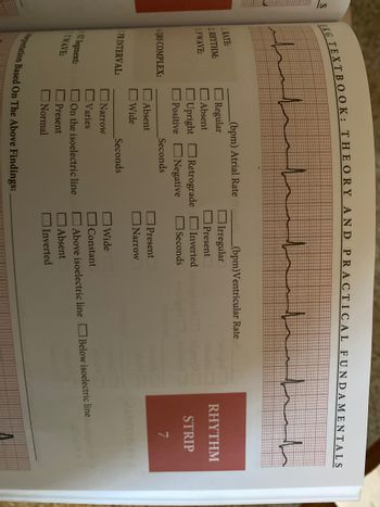 EKG TEXT
L RATE:
2 RHYTHM:
PWAVE:
4QRS COMPLEX:
PRINTERVAL:
ST Segment:
STWAVE:
OOK: THEORY AND PRACTICAL FUNDAMENTALS
سلسللسلسل
(bpm) Atrial Rate
Regular
Absent
Upright Retrograde
Positive
Negative
Absent
Wide
Seconds
Seconds
Narrow
Varies
On the isoelectric line
Present
Normal
terpretation Based On The Above Findings: _
(bpm)Ventricular Rate
Irregular
Present
Inverted
Seconds
Present
Narrow
Wide
Constant
Above isoelectric line
Absent
Inverted
RHYTHM
STRIP
7
Below isoelectric line