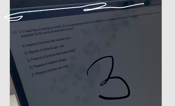 2
137. A 17-week fetus is developing normally. She has age-appropriate external female genitalia and a developing uterus, vagina, and falopan tubes. Which of the blowing is the most by
explanation for this normal developmental process?
A) Absence of functional fetal testicular tissue
OB) Migration of primordial germ cells
OC) Presence of functional fetal ovarian tissue
OD) Presence of maternal estrogen
OE) Presence of primary sex cords
3