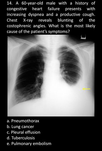 Answered: 14. A 60-year-old male with a history… | bartleby