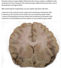 Schwann cells are a type of glial cell found in the nervous system. In addition to the
conduction of nerve impulses, the outermost layer called neurilemma aids in nerve
development and regeneration.
After examining the image below, can you explain why brain cells have
a. Neurons in the central nervous system lack neurilemma of Schwann cells.
b. Neurons in the central nervous system are surrounded by white matter.
c. Axons of the peripheral nervous system lack neurilemma of Schwann cells.
d. Neurons in the peripheral nervous system are surrounded by grey matter.
