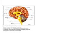 Cingulate gyrus-
Parietal lobe
Cerebral cortex
Frontal lobe
-Thalamus
Corpus callosum-
Tissue dividing-
lateral ventricles
- Occipital lobe
Nucleus accumbens-
- Superior and
inferior colliculi
Hypothalamus -
Midbrain
Pituitary gland-
Pons
Cerebellum
Medulla
Spinal cord-
Central canal of
spinal cord
|11. Damage to the brain stem would cause
a. losses in senses of touch, pain, and temperature
b. massive decrease in the ability to synthesize and process information
c. catastrophic loss of control for vital functions like breathing and heart rate
d. interruptions in memory and organization skills
