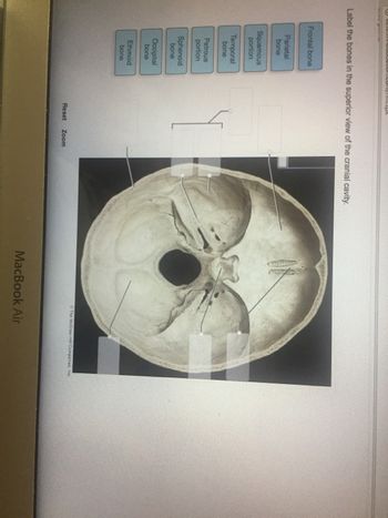 Answered: Label the bones in the superior view of… | bartleby