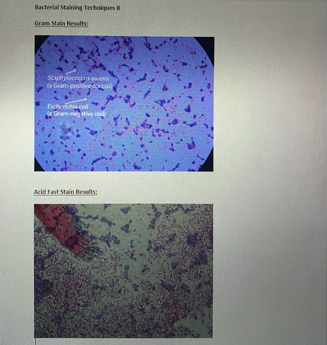 staphylococcus aureus acid fast stain
