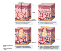 Answered: Microorganisms Epidermis -Dermis… | bartleby