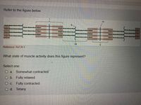 Refer to the figure below.
一
IV
I
Reference: Ref 20-1
What state of muscle activity does this figure represent?
Select one:
a Somewhat contracted
O b. Fully relaxed
O c. Fully contracted
O d. Tetany
