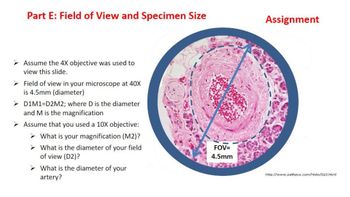 Part E: Field of View and Specimen Size
Assignment
Assume the 4X objective was used to
view this slide.
➤Field of view in your microscope at 40X
is 4.5mm (diameter)
➤D1M1=D2M2; where D is the diameter
and M is the magnification
➤ Assume that you used a 10X objective:
➤ What is your magnification (M2)?
➤ What is the diameter of your field
of view (D2)?
➤What is the diameter of your
artery?
FOV=
4.5mm
http://www.pathguy.com/histo/023.html