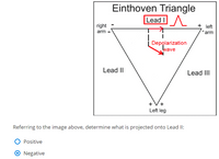 Einthoven's triangle projected onto the human body