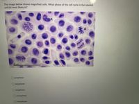 The image below shows magnified cells. What phase of the cell cycle is the labeled
cell (A) most likely in?
素。
50 um
prophase
telophase
O anaphase
o metaphase
interphase
