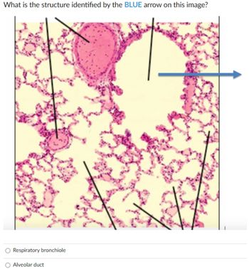 Answered: Respiratory bronchiole | bartleby