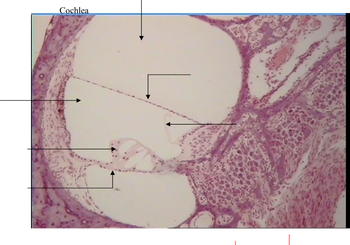 This histological image shows a section of respiratory epithelium, illustrating the ciliated pseudostratified columnar epithelium found in the trachea and upper respiratory tract. Each labeled component plays a specific role in maintaining respiratory health:

1. **Cilia**: These hair-like structures extend from the surface of ciliated cells. Their primary function is to move mucus and trapped particles out of the respiratory tract.

2. **Goblet Cell**: These are specialized epithelial cells responsible for secreting mucus. Mucus serves to trap dust, pathogens, and particles, preventing them from reaching deeper parts of the respiratory system.

3. **Basal Cell**: These cells act as progenitor cells, capable of dividing and differentiating into other types of epithelial cells, playing a critical role in the repair and regeneration of the epithelium.

4. **Basement Membrane**: This thin, fibrous layer underlies the epithelium, providing structural support and anchoring the epithelial cells to connective tissue.

5. **Lamina Propria**: The layer of connective tissue beneath the epithelium. It contains blood vessels, nerves, and immune cells essential for nutrient exchange and defense mechanisms.

The image provides a detailed visualization of healthy respiratory epithelium, essential for both understanding normal airway function and recognizing pathological changes in respiratory diseases.