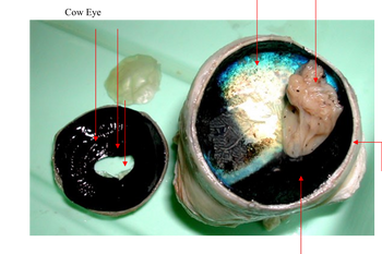 The image showcases a dissected human eyeball with various parts labeled for educational purposes:

1. **Cornea and Sclera**: The outermost layer of the eye is visible. The cornea is transparent and prominently positioned, while the sclera is the white part surrounding it.

2. **Pupil and Iris**: Visible at the center of the eye. The pupil appears as a dark circle, surrounded by the iris, which is often colored.

3. **Aqueous Humor**: The fluid-filled space between the cornea and the lens area is indicated, although not directly visible in the image.

4. **Lens**: Positioned behind the pupil and iris, the lens appears transparent and is responsible for focusing light onto the retina.

5. **Retina and Choroid**: The back of the eye is highlighted, showing layers responsible for receiving light and housing blood vessels.

6. **Optic Nerve**: This is indicated at the back, which transmits visual information from the retina to the brain.

The dissection reveals the internal structure of the eye, providing insights into the components involved in the human visual system.