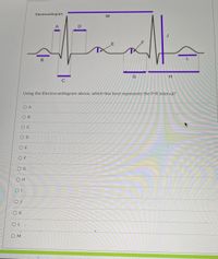 Electrocardiogram
D
J
.F
В
H.
C
Using the Electrocardiogram above, which line best represents the P-R interval?
O A
O B
O C
OD
O E
O F
OG
Он
OK
OL
O M
E
