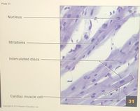 Plate 31
Nucleus
Striations
Intercalated discs
Cardiac muscle cell-
31
Copyright 2010 Pearson Education, inc.
