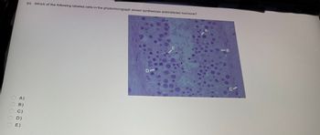 00
A)
B)
C)
D)
E)
Customized Subject Test
63. Which of the following labeled cells in the photomicrograph shown synthesizes antimüllerian hormone?
<-B