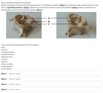 Refer to the photos below of the vertebrae.
Marker A represents a landmark that the head rotates on. This landmark is called the Blank 1, meaning the vertebra near the bottom of each
photo is specifically named the Blank 2. Marker B is a site for back muscles to attach and is called the Blank 3. Marker C represents the
passage where the spinal cord would be, called the Blank 4.
Choose from the following options to fill in the blanks:
dens
axis (C2)
transverse process
vertebral foramen
spinous process
centrum
atlas (C1)
thoracic vertebra
lumbar vertebra
sacral vertebra
Blank 1 Add your answer
Blank 2 Add your answer
Blank 3 Add your answer
Blank 4 Add your answer
ABC