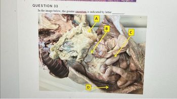 QUESTION 33
In the image below, the greater guentum is indicated by letter
A
D
B
C