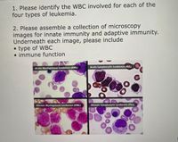 1. Please identify the WBC involved for each of the
four types of leukemia.
2. Please assemble a collection of microscopy
images for innate immunity and adaptive immunity.
Underneath each image, please include
• type of WBC
• immune function
Acute Myelogenous Leukemia (AML)
Acute Lymphocytic Leukemia (ALL)
Chronic Myelogenous Leukemia (CML)
Chronic Lymphocytic Leukemia (CLL)
