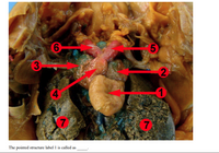 5.
4
7.
(7
The pointed structure label 1 is called as
