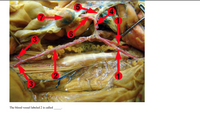 3.
6.
3.
The blood vessel labeled 2 is called
