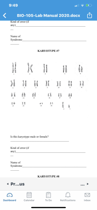 3
10
11
12
13
14
15
16
18
19
20
21
22
Y
Is this karyotype male or female?
Kind of error (if
any).
Name of
Syndrome
