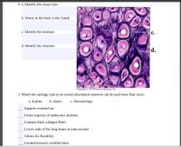 4. a. Identify this tissue type:
b. Where in the body is this found:
c. Identify the structure:
с.
d. Identify the structure:
d.
Copyright © 2010 Pearson Education, Inc.
5. Match the cartilage type to its correct description (answers can be used more than once).
a. hyaline
b. elastic
c. fibrocartilage
Supports external ear
Forms majority of embryonic skeleton
Contains thick collagen fibers
Covers ends of the long bones in joint cavities
Allows for flexibility
Located between vertebral discs
