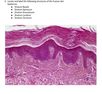 II. Locate and label the following structures of the human skin
Epidermis
• Stratum Basale
• Stratum Spinosum
• Stratum Granulosum
Stratum Lucidum
• Stratum Corneum
BRAR
