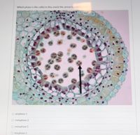 Which phase is the cell's) in (the onels) the arrow is pointing to
O prophase 1
O metaphase 2
O metaphase 1
O telophase 1
