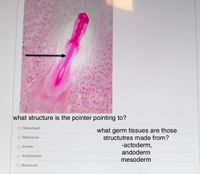 what structure is the pointer pointing to?
O Notochord
what germ tissues are those
structutres made from?
-actoderm,
O Blastopore
Somite
andoderm
O Archenteron
mesoderm
O Blastocoel
