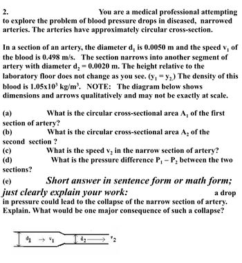 2.
You are a medical professional attempting
to explore the problem of blood pressure drops in diseased, narrowed
arteries. The arteries have approximately circular cross-section.
In a section of an artery, the diameter d, is 0.0050 m and the speed v₁ of
the blood is 0.498 m/s. The section narrows into another segment of
artery with diameter d₂ = 0.0020 m. The height relative to the
laboratory floor does not change as you see. (y₁ = y₂.) The density of this
blood is 1.05x10³ kg/m³. NOTE: The diagram below shows
dimensions and arrows qualitatively and may not be exactly at scale.
(a)
section of artery?
(b)
second section ?
What is the circular cross-sectional area A₁ of the first
(c)
(d)
sections?
What is the circular cross-sectional area A₂ of the
What is the speed v₂ in the narrow section of artery?
What is the pressure difference P₁ - P₂ between the two
1
2
(e)
Short answer in sentence form or math form;
just clearly explain your work:
a drop
in pressure could lead to the collapse of the narrow section of artery.
Explain. What would be one major consequence of such a collapse?
d₁ → 1
d₂