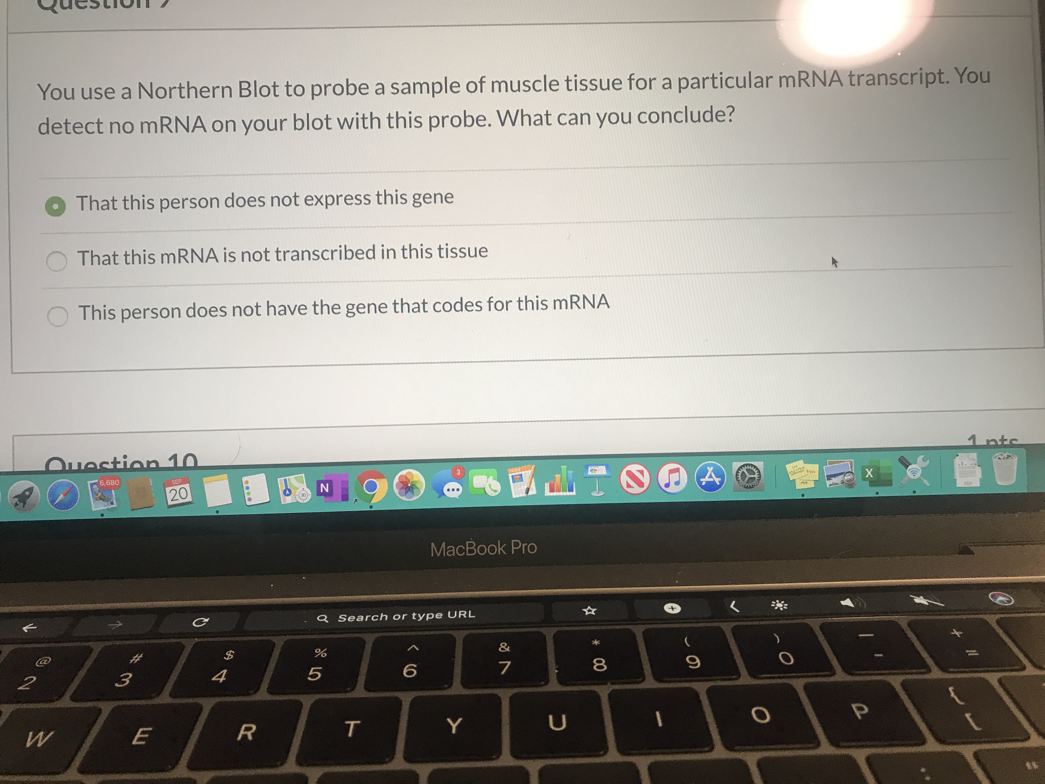 You use a Northern Blot to probe a sample of muscle tissue for a particular MRNA transcript. You
detect no MRNA on your blot with this probe. What can you conclude?
That this person does not express this gene
That this MRNA is not transcribed in this tissue
This person does not have the gene that codes for this MRNA
Ouestion 10
1 nts
6,680
SEP
33
20
SSE-756
Eq43
Lea
X
POF
MacBook Pro
C
Q Search or type URL
$
&
2
3
4
6
7
9
O
E
Y
U
P
00
T
LO
RC
