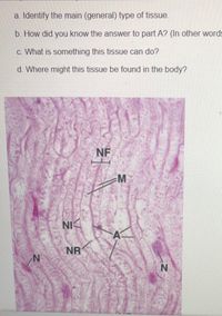 a. Identify the main (general) type of tissue.
b. How did you know the answer to part A? (In other words
c. What is something this tissue can do?
d. Where might this tissue be found in the body?
NF
M
NI
NR
N'
