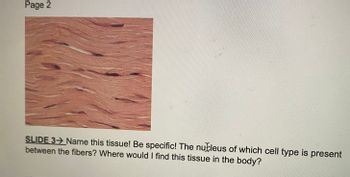 **Page 2**

**SLIDE 3** ➔ Name this tissue! Be specific! The nucleus of which cell type is present between the fibers? Where would I find this tissue in the body?

**Image Description:** 
The image shows a histological slide of tissue with elongated, wavy fibers running parallel to each other. There are visible dark nuclei interspersed between the fibers, characteristic of a certain type of tissue.

**Educational Note:**
This slide likely displays a type of connective tissue. Consider the cellular structure, arrangement, and presence of nuclei to determine the tissue type. Additionally, think about common locations of this tissue within the human body to relate structure to function.