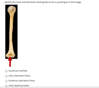 Humerus Bone Markings - Upper Portion Diagram