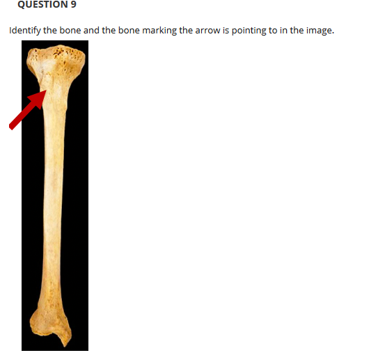 condyle bone marking