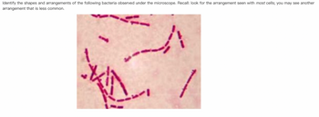 Identify the shapes and arrangements of the following bacteria observed under the microscope. Recall: look for the arrangement seen with most cells; you may see another
arrangement that is less common.
1