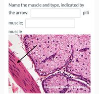 Name the muscle and type, indicated by
the arrow:
pili
muscle;
muscle
Copyright Nielsetr & Miller,
