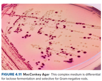 Answered: FIGURE 4.11 MacConkey Agar This complex… | bartleby