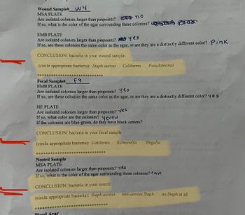 Wound Sample#___ W4
MSA PLATE
Are isolated colonies larger than pinpoints? Do no
If so, what is the color of the agar surrounding these colonies?hots pink
EMB PLATE
Are isolated colonies larger than pinpoints?
Yes
If so, are these colonies the same color as the agar, or are they are a distinctly different color? Pink
CONCLUSION: bacteria in your wound sample:
(circle appropriate bacteria): Staph aureus Coliforms
***********
Fecal Sample#_
F9
EMB PLATE
Are isolated colonies larger than pinpoints? Yes
If so, are these colonies the same color as the agar, or are they are a distinctly different color? yes
HE PLATE
Are isolated colonies larger than pinpoints?
If so, what color are the colonies? Yellow
If the colonies are blue-green, do they have black centers?
CONCLUSION: bacteria in your fecal sample
(circle appropriate bacteria): Coliforms
*****
Blood Agar
******
yes
****
Pseudomonas
Salmonella
*********
Nostril Sample
MSA PLATE
Are isolated colonies larger than pinpoints? es
If so, what is the color of the agar surrounding these colonies? tan
CONCLUSION: bacteria in your nostril:
(circle appropriate bacteria): Staph aureus
Shigella
non-aureus Staph
no Staph at all
