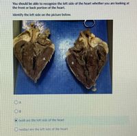 You should be able to recognize the left side of the heart whether you are looking at
the front or back portion of the heart.
Identify the left side on the picture below.
OA
Oboth arc the lett side of the heart
Oncither are the left side of the heart
