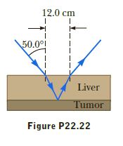 12.0 cm
50.00
Liver
Tumor
Figure P22.22
