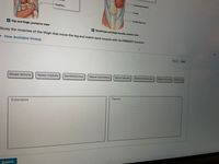 **Title: Understanding the Muscles of the Thigh and Their Primary Functions**

The image includes diagrams of the muscles in the hip and thigh, displayed in both posterior and anterior views. The primary focus is on understanding the function of each muscle involved in moving the leg.

**Instructions:**

Study the muscles of the thigh that move the leg and match each muscle with its primary function.

**Muscles Listed:**

- Biceps femoris
- Vastus medialis
- Semitendinosus
- Vastus intermedius
- Vastus lateralis
- Semimembranosus
- Rectus femoris
- Sartorius

**Task:**

These muscles are to be categorized under two primary functions:

1. **Extensors**
2. **Flexors**

**Interface Details:**

- The interface provides a drag-and-drop area with labeled buttons for each muscle.
- Two empty boxes labeled "Extensors" and "Flexors" are provided for categorization.
- Options for "Reset" and "Help" are available to assist users.

Click the "Submit" button once you have matched each muscle with its primary function.