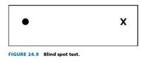 FIGURE 24.9 Blind spot test.
