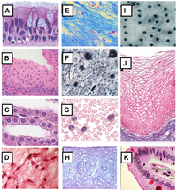 Answered: Identify the epithelial and connective… | bartleby