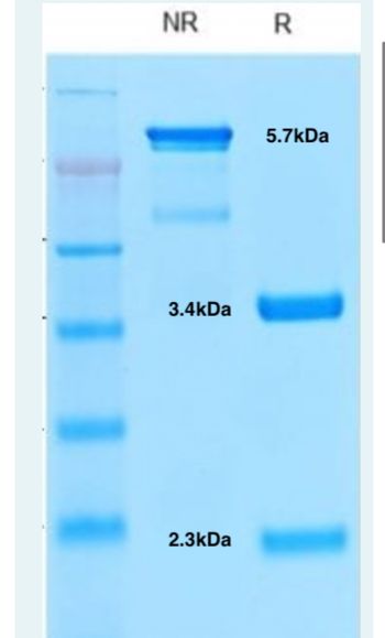 NR
11
3.4kDa
2.3kDa
R
5.7kDa