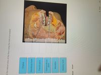 el the lateral view of the face using the hints if provided.
Gingiva
Mandibular teeth
Parotid gland
00
Submandibular
gland
Mandible
Maxillary teeth
Reset
Zoom
<Prev
