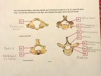 For all numbered labels, name the specific part of the bone except for 51 & 52, name the bone
only. For the two vertebrae on the right, also indicate the region where they are found.
1spinal canal
54
51
Transverse
Posterior
55
Foramen
arch
56 Spinous p rocess
Mark Nielsen and Shawn Miller
lamina
57
Transverse
58
Process
Super
Particulating
Process
Pedicle
52
59
53
60
Vertebral
(olumn
Pedicle
Mark Nieisen and Shawn Mller
Mark he
